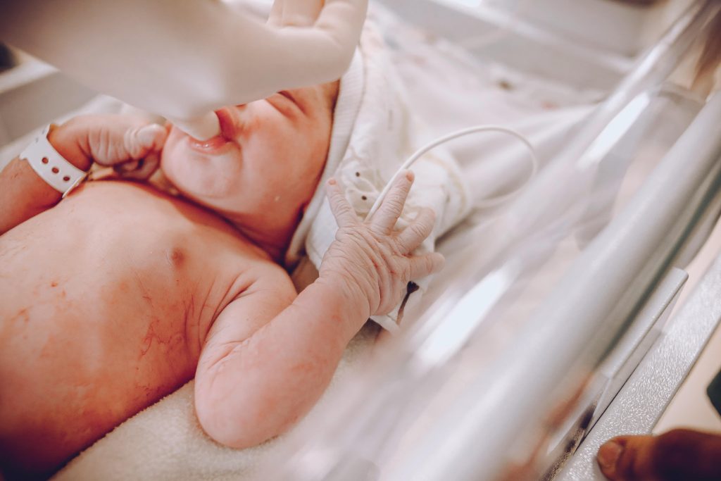 Eczema in Infants Babies